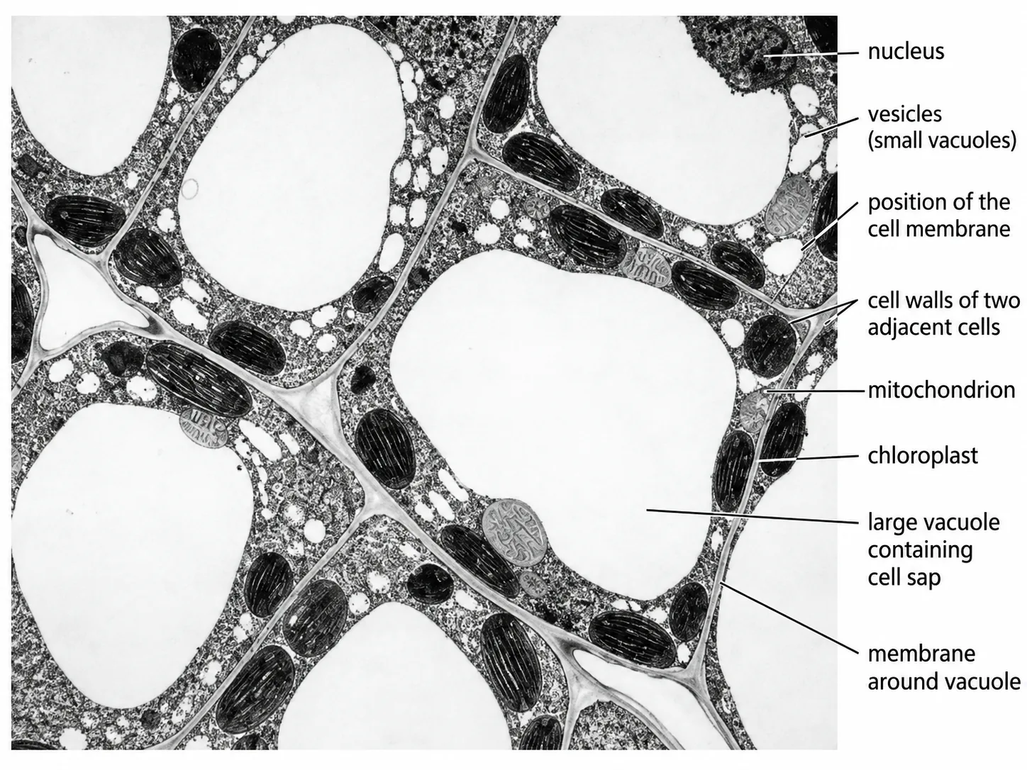 Electron micrograph of plant cells with labels