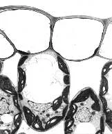 Plant cells viewed with a transmission electron microscope