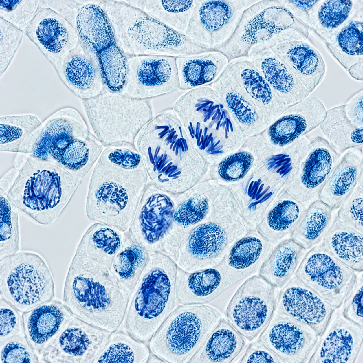 Dividing plant cells illustrating stages of mitosis