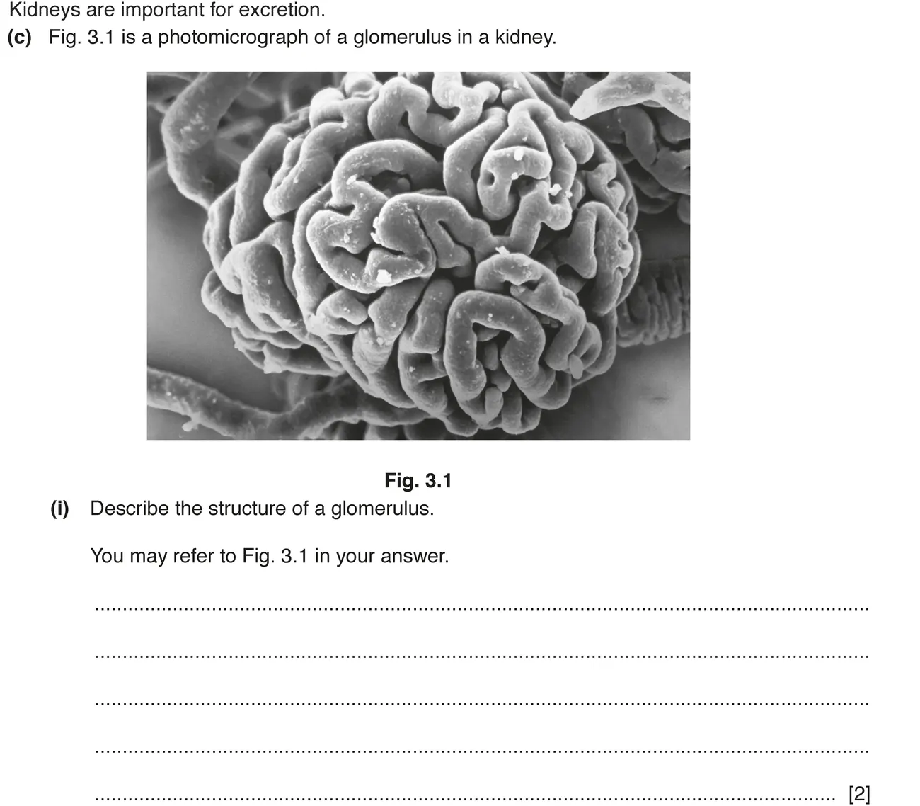 Checkpoint quiz written question 1 (c)(i)